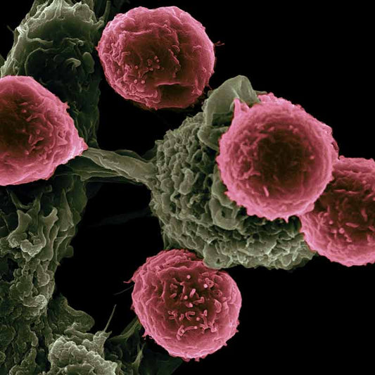 More physical activity reduces the risk of dying of cancer